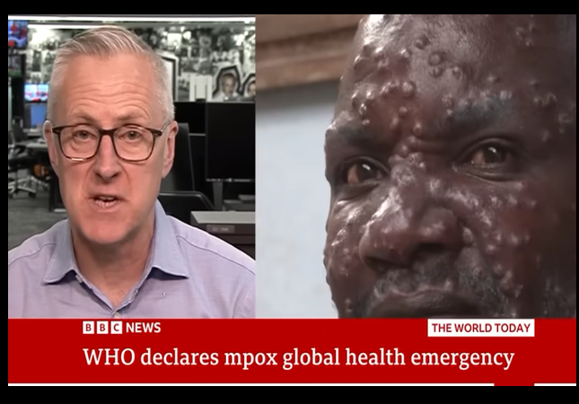 WHO Declares Virulent Monkeypox Strain a Global Public Health Emergency