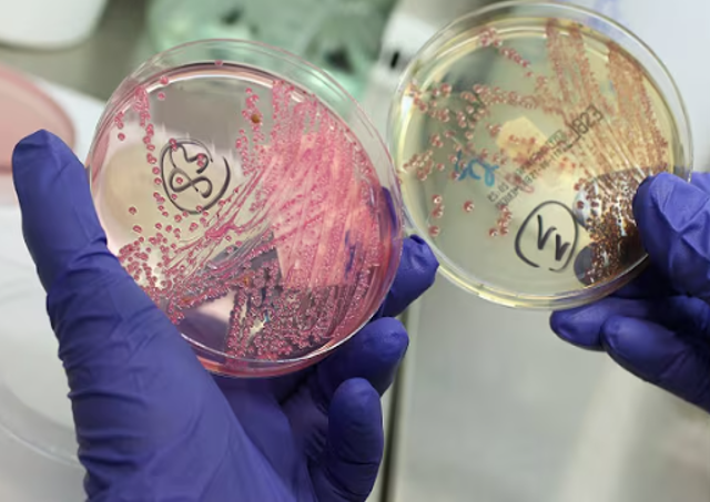 Chinese Researcher on US Visa Charged with Smuggling E. Coli Into the Country